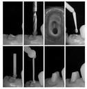 Postes de fibra para restauración dental Forcepost, x 5u. DSP