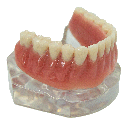 Modelo acrílico de sobredentadura con pilares esféricos. ML